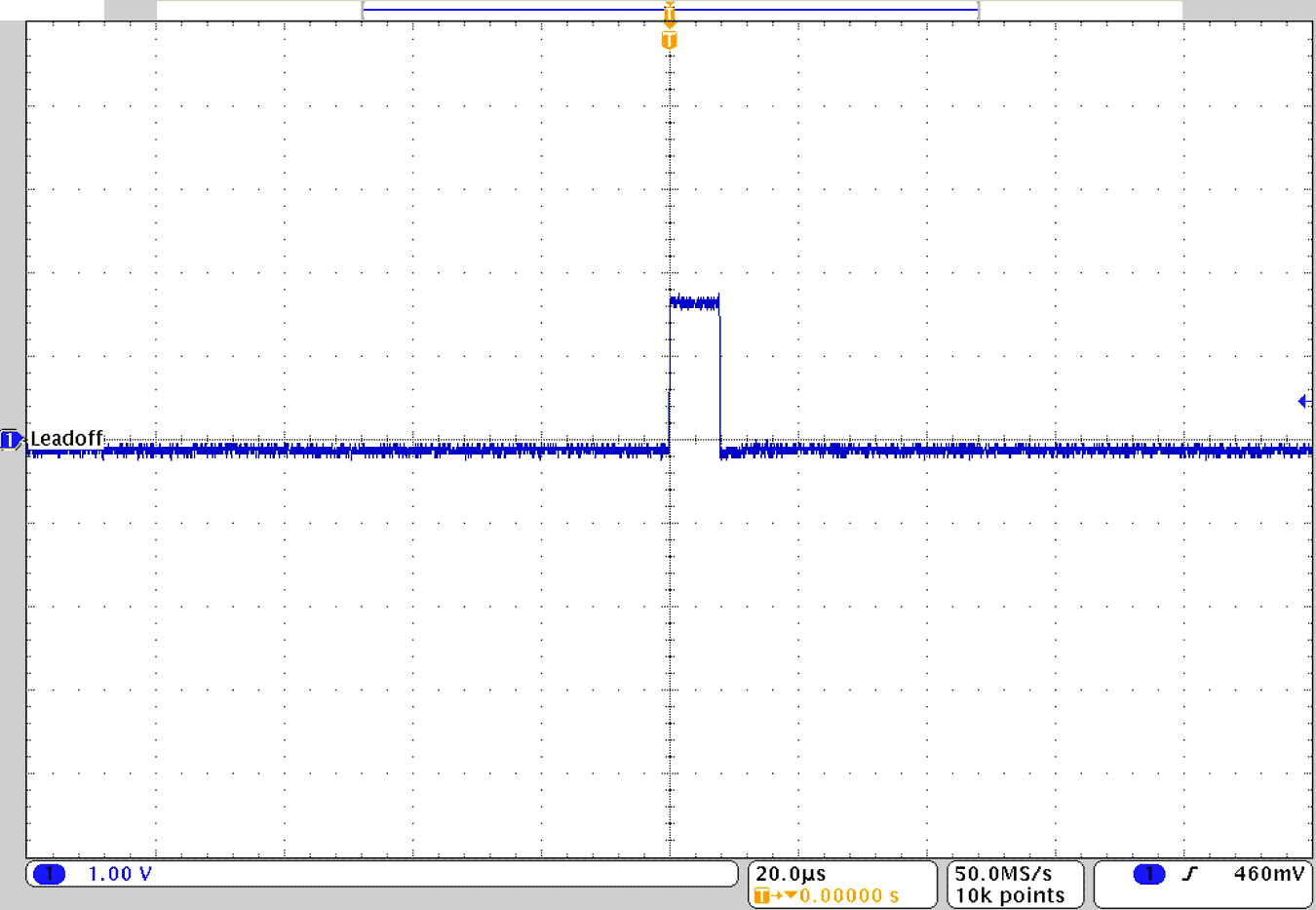 TIDA-010270 GPIO2 上的直流導(dǎo)聯(lián)脫落檢測(cè)中斷